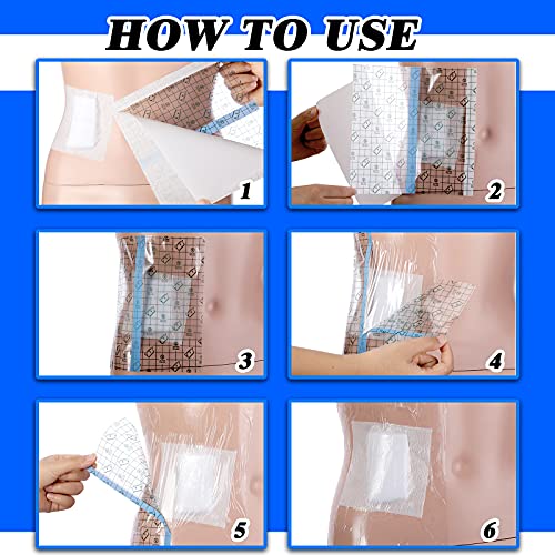 Dialysis Catheter Shower Cover Peritoneal Dialysis Accessories Protector Waterproof Transparent Bandage Wound Cover Bandage Belt for Swimming Tattoo Dressings, 7.87 x 7.87 Inches (25 Pieces) | The Storepaperoomates Retail Market - Fast Affordable Shopping