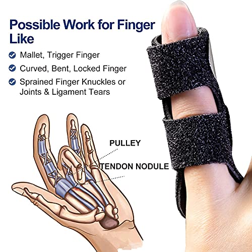 Yzhmjl 6PCS Trigger Finger Splints, Trigger Finger Brace Finger Straightener Finger Support, Finger Splint for All Fingers | The Storepaperoomates Retail Market - Fast Affordable Shopping