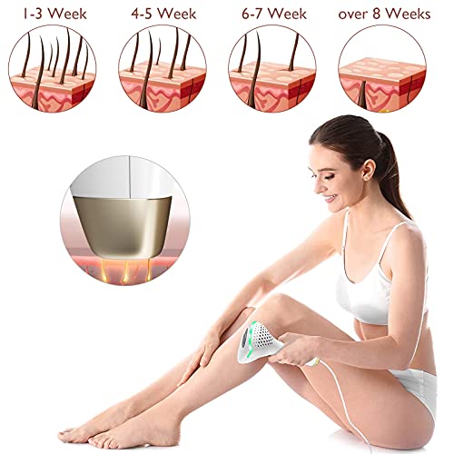 Laser Hair Removal at-Home Use for Women&Men 100% Safe & 500,000 Flashes Permanent Painless IPL Hair Removal Devices with Auto&Manual Modes,Use for Armpits,Legs,Arm (Gold) | The Storepaperoomates Retail Market - Fast Affordable Shopping