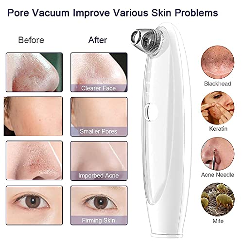 Pore Vacuum Blackhead remover with camera,LeveTop visible facial pimple extractor wifi wireless connect real-time dirty things suck out,New Upgraded face suction pore cleanser for men&women | The Storepaperoomates Retail Market - Fast Affordable Shopping