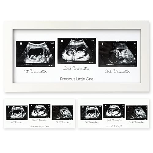 Sonogram Picture Frame – Trio Ultrasound Picture Frames For Mom To Be Gift – Baby Ultrasound frame – Pregnancy Announcements Sonogram frame – Baby Nursery Decor, Pregnant Mom Gifts (Alpine White)