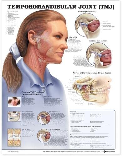 Temporomandibular Joint (TMJ) Anatomical Chart | The Storepaperoomates Retail Market - Fast Affordable Shopping