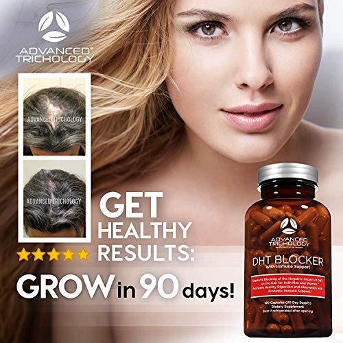 DHT Blocker – Hair Growth Supplement for Genetic Thinning for Men and Women | Approved* by American Hair Loss Association | Guaranteed, Backed by 20 Years of Experience in Hair Loss Treatment Clinics | The Storepaperoomates Retail Market - Fast Affordable Shopping