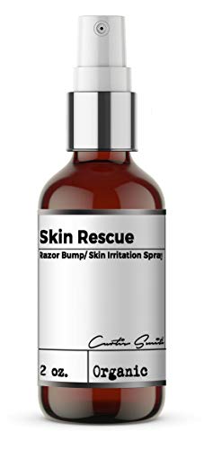 Xotics Skin Rescue Razor Bump (2oz) – Skin Irritation Spray, All Natural Barber Aftershave Razor Burn Treatment for Men/Women – Anti itch spray for tattoo aftercare, calm down razor bumps
