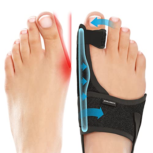 Caretras Bunion Corrector for Women & Men 2pc – Orthopedic Bunion Splint & Big Toe Straightener for Hallux Valgus – Hammer Toe Corrector & Foot Brace for Bunion Relief – Day & Overnight Support