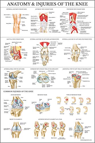 Palace Learning Laminated Anatomy and Injuries of the Knee Poster – Knee Joint Anatomical Chart – 18″ x 24″