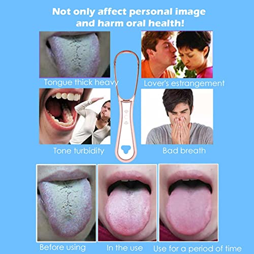 Bafiigoda Fresh T_ongue C_leaner,Tongue S_craper,Reusable Fight Bad Breath Healthy O_RAL Care for Adults Kids – 100% B_P_A | The Storepaperoomates Retail Market - Fast Affordable Shopping