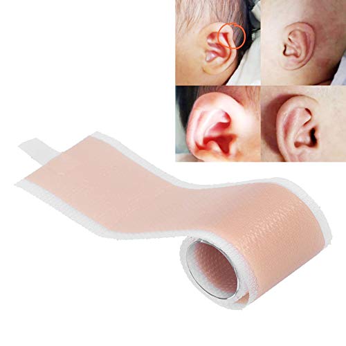 Ear Aesthetic Corrector,Baby Protruding Ear Patch,to Correct Deformed Ears,Newborn Ear Aesthetic Corrector,Corrector for Protruding Ear Silicone | The Storepaperoomates Retail Market - Fast Affordable Shopping
