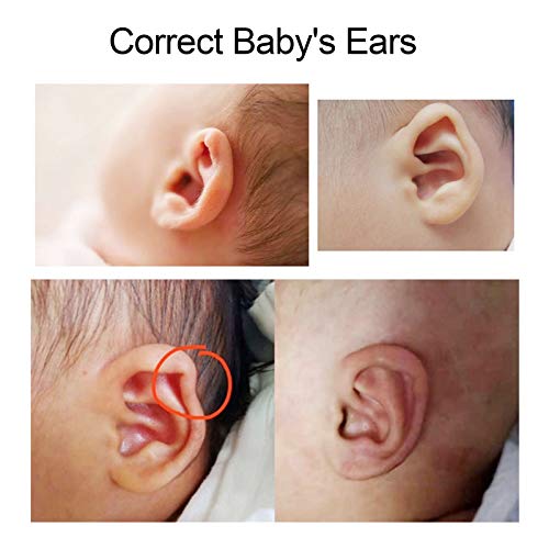 Ear Aesthetic Corrector,Baby Protruding Ear Patch,to Correct Deformed Ears,Newborn Ear Aesthetic Corrector,Corrector for Protruding Ear Silicone | The Storepaperoomates Retail Market - Fast Affordable Shopping