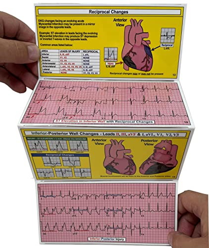 R-CAT – 12 for STEMI 2nd Edition | The Storepaperoomates Retail Market - Fast Affordable Shopping