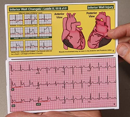 R-CAT – 12 for STEMI 2nd Edition | The Storepaperoomates Retail Market - Fast Affordable Shopping