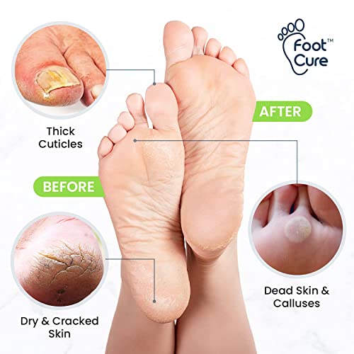 Foot Cure Foot Exfoliator & Callus Remover Pedicure Set – Foot Care Kit Includes Foot File for Dead Skin, Tea Tree Oil Foot Soak Salts, Urea Cream 40 Percent & Foot Callus Removal Gel – Made in USA | The Storepaperoomates Retail Market - Fast Affordable Shopping